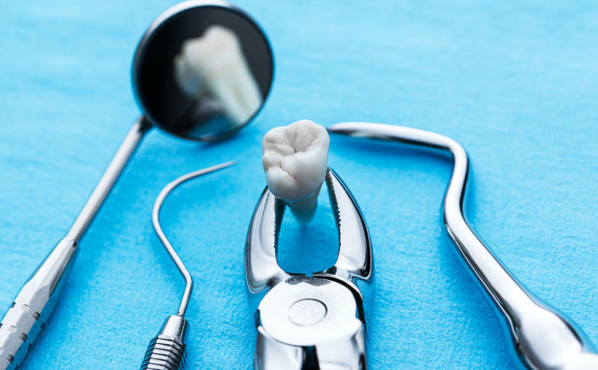 Cosa fare dopo l'estrazione del dente: cosa può e non può