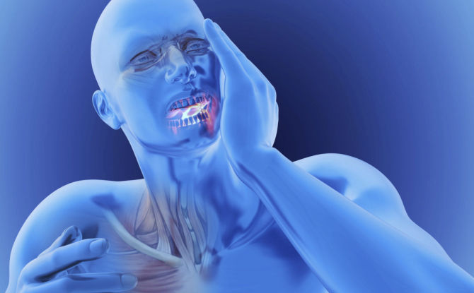 Tại sao hàm dưới hoặc hàm trên bị đau, phải làm gì với đau ở hàm