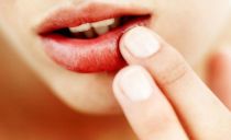 التهاب الفم عند البالغين: الأسباب والأعراض والعلاج
