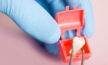 Removing a wisdom tooth: indications for surgery, removal procedure