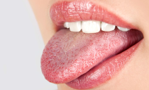 La lengua duele de lado y en la base: qué significa, razones, cómo tratar