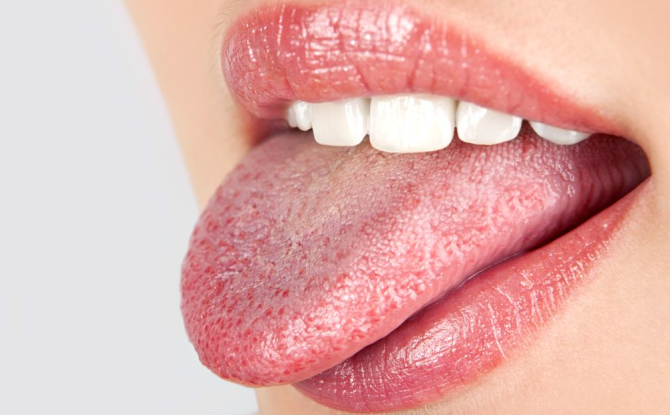 De tong doet pijn aan de zijkant en aan de basis: wat betekent het, redenen, dan behandelen