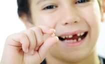 How to pull a baby tooth out at home without pain