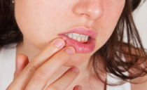 Из којих разлога се појављују беле тачкице, флеке, осипи, мрље на уснама