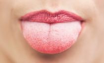 Gul plakett i tungen: årsaker og behandling