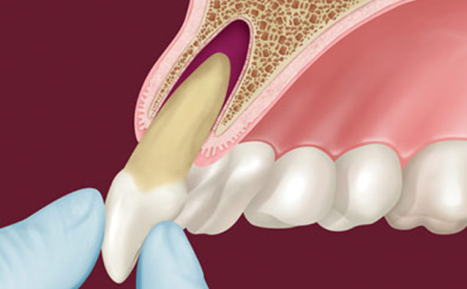 Kas yra dantų alveolės ir kur jos yra