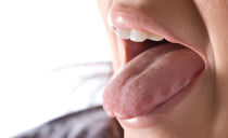 Malattie della lingua: tipi, sintomi, descrizione dei sintomi, foto, trattamento