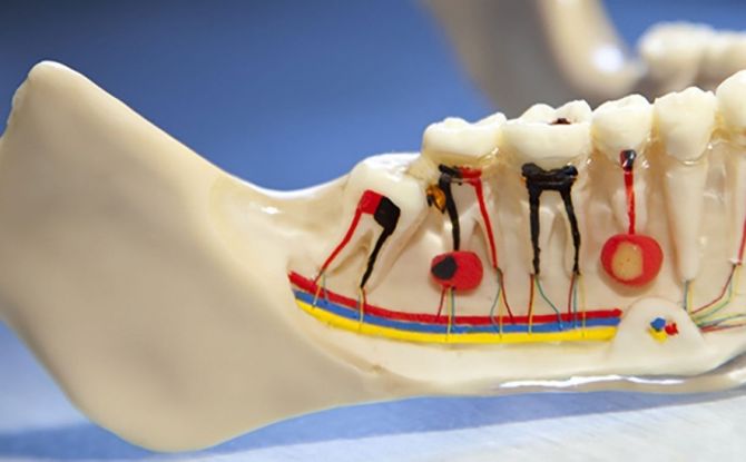 Циста зуба: узроци, симптоми, конзервативно и кућно лечење