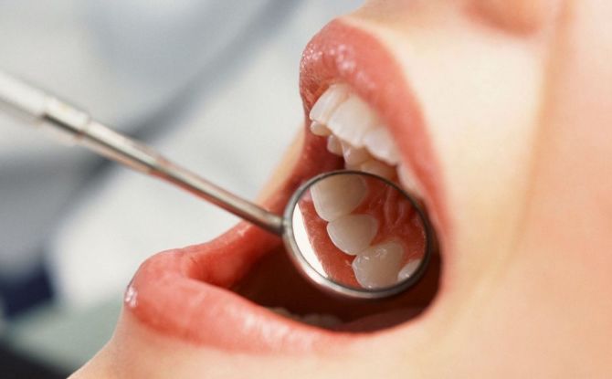 מהי גרנולומה של שורש שיניים וכיצד ניתן לרפא אותה