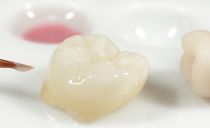 כתרים על שיניים: סוגים, יתרונות, חסרונות והליך התקנה