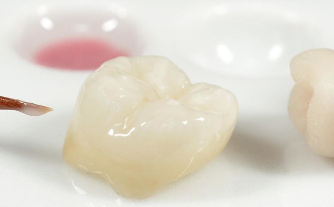 Koronák a fogakon: típusok, érvek, hátrányok és telepítési eljárás