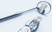 هل من الضروري إزالة أسنان الحكمة: لماذا وفي أي الحالات يقومون بإزالتها
