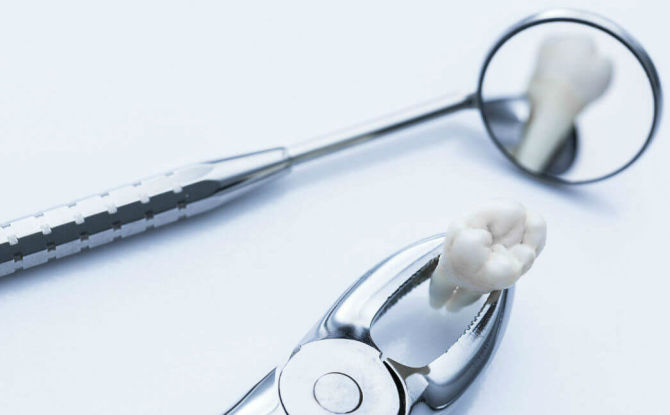 Est-il nécessaire de retirer les dents de sagesse: pourquoi et dans quels cas les enlèvent-elles?