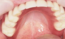 Miệng tôi đau: nguyên nhân, điều trị và phòng ngừa