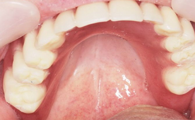 Ma bouche me fait mal: causes, traitement et prévention