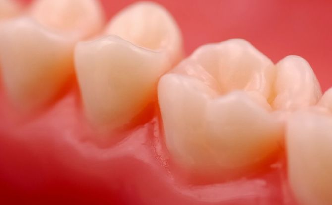 Kaip namuose greitai sustiprinti silpnas ir laisvas dantenas, naudojant liaudies vaistus