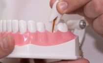 Classification of prosthetics, types of dentures, how to choose the best