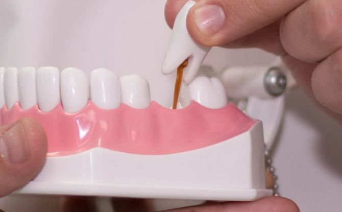 การจำแนกประเภทของขาเทียมประเภทของฟันปลอมวิธีการเลือกที่ดีที่สุด