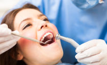 Obnova zubů - před a po obrázcích, typy výplní