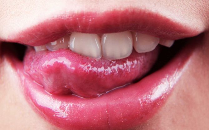 סדקים בלשון: גורמים, תסמינים וטיפול