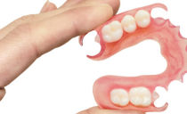 Removable full and partial nylon dentures: types, pros and cons, care