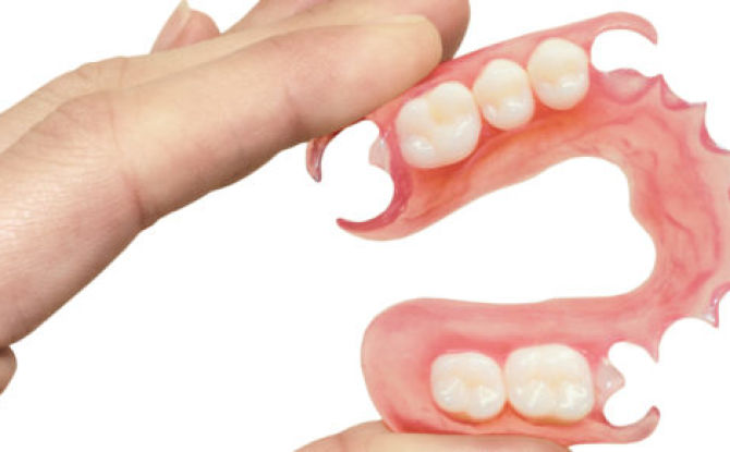 طقم أسنان نايلون كامل وجزئي قابل للإزالة: أنواع ، إيجابيات وسلبيات ، رعاية