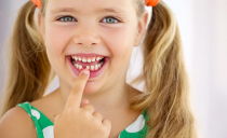 حيث ، مخطط وإجراء استبدال الأسنان الأولية في الأطفال مع دائم