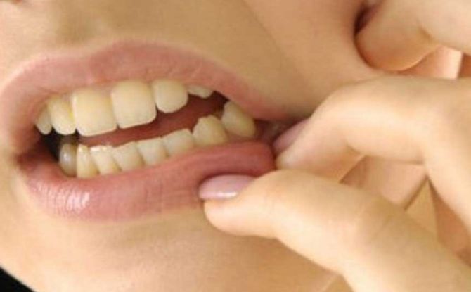 Tänder och tandkött kliar: möjliga skäl till vad man ska göra
