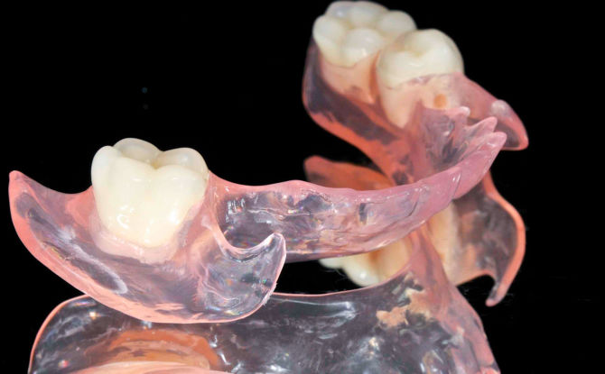 Protesi dentarie di nuova generazione senza palato con assenza totale e parziale di denti