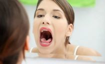 Abses pada tonsil dan tonsil: sebab dan rawatan