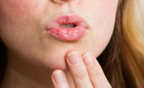 Pourquoi les lèvres sèchent