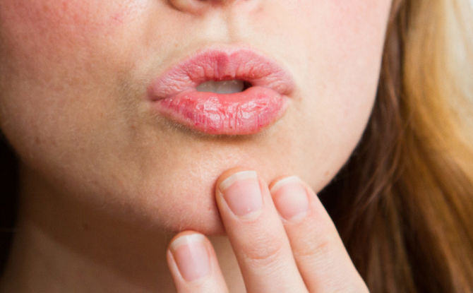 Pourquoi les lèvres sèchent