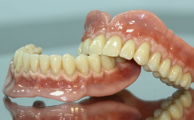 Dentaduras removibles: que es, tipos, materiales, como usar