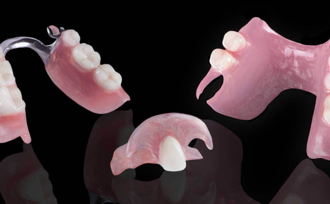 Prothèses amovibles et non amovibles avec absence partielle de dents: types et photos