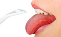 Blisters and vesicles in the tongue: types, causes, therapy