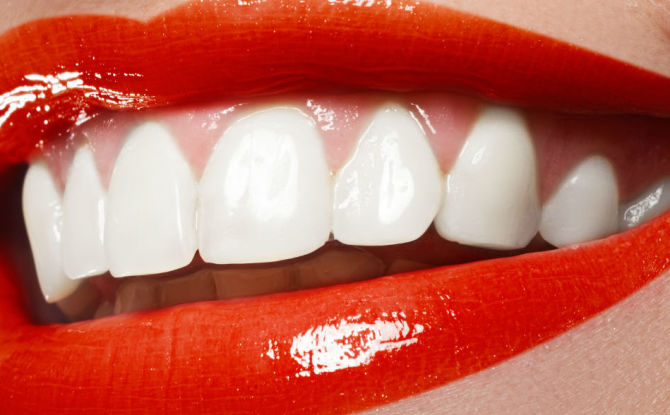How much does teeth whitening cost at the dentist and at home