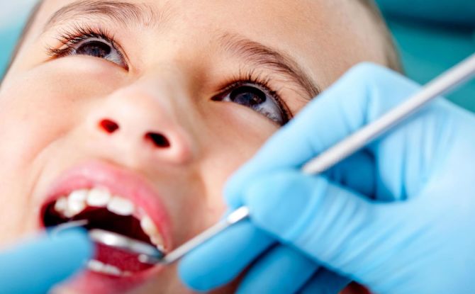 Пулпитис бебиног зуба код детета - симптоми, фазе лечења, превенција