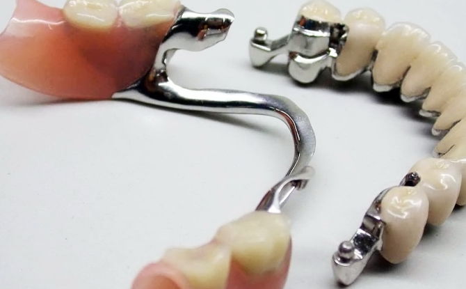 Dental prosthetics with arch prostheses: design features, types, cost