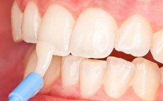 שיקום אמייל שיניים: ברפואת שיניים, בבית