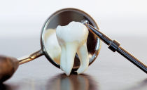 Doped and retined teeth: intipati patologi, penyingkiran