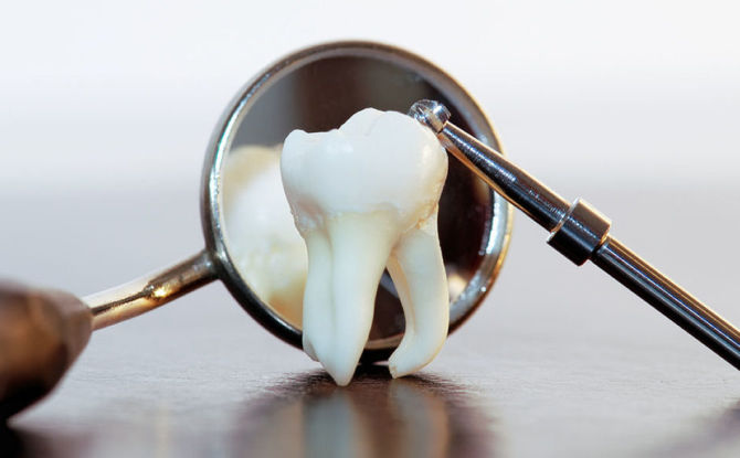 أسنان مخدرة وشبكية: جوهر علم الأمراض ، الإزالة