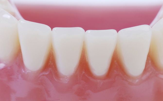 Akné v ústech na dásni nad zubem: možné příčiny, jak zacházet