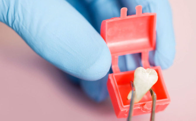 Múdrosť zub: Známky a príznaky rastu
