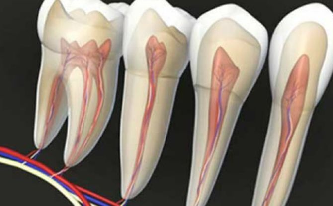 Dental nerve pamamaga: sintomas, paggamot, pamamahala ng sakit sa bahay