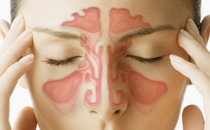 Kyste du sinus maxillaire: causes, symptômes, traitement et ablation