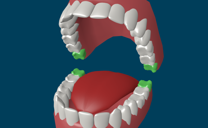 Zubi mudrosti: struktura, značajke rasta, indikacije za uklanjanje