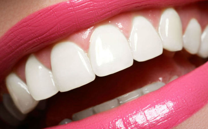 Hur man gör tänderna vita hemma och på kliniken, hur man håller tänderna vita
