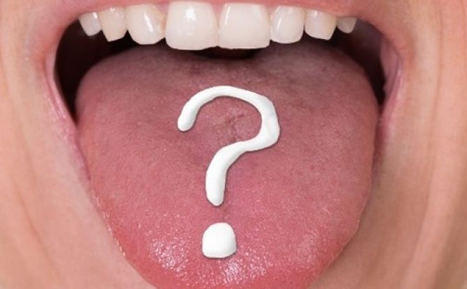 Erkrankungen der Mundhöhle und der Zunge: Arten von Pathologien und Methoden zu ihrer Behandlung