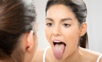Glossitis of the tongue: types, causes, treatment