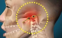 Varför gör käken nära örat ont från en eller två sidor, behandlingsalternativ